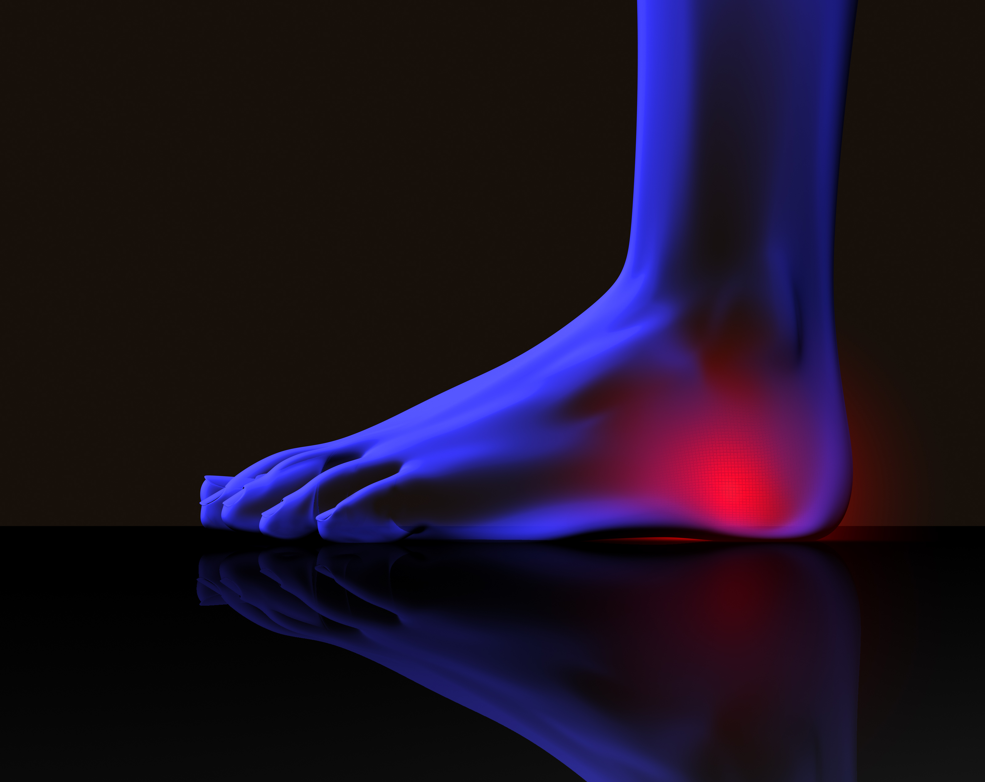 five-heel-pain-causes-atlanta-podiatry-american-foot-leg-specialists