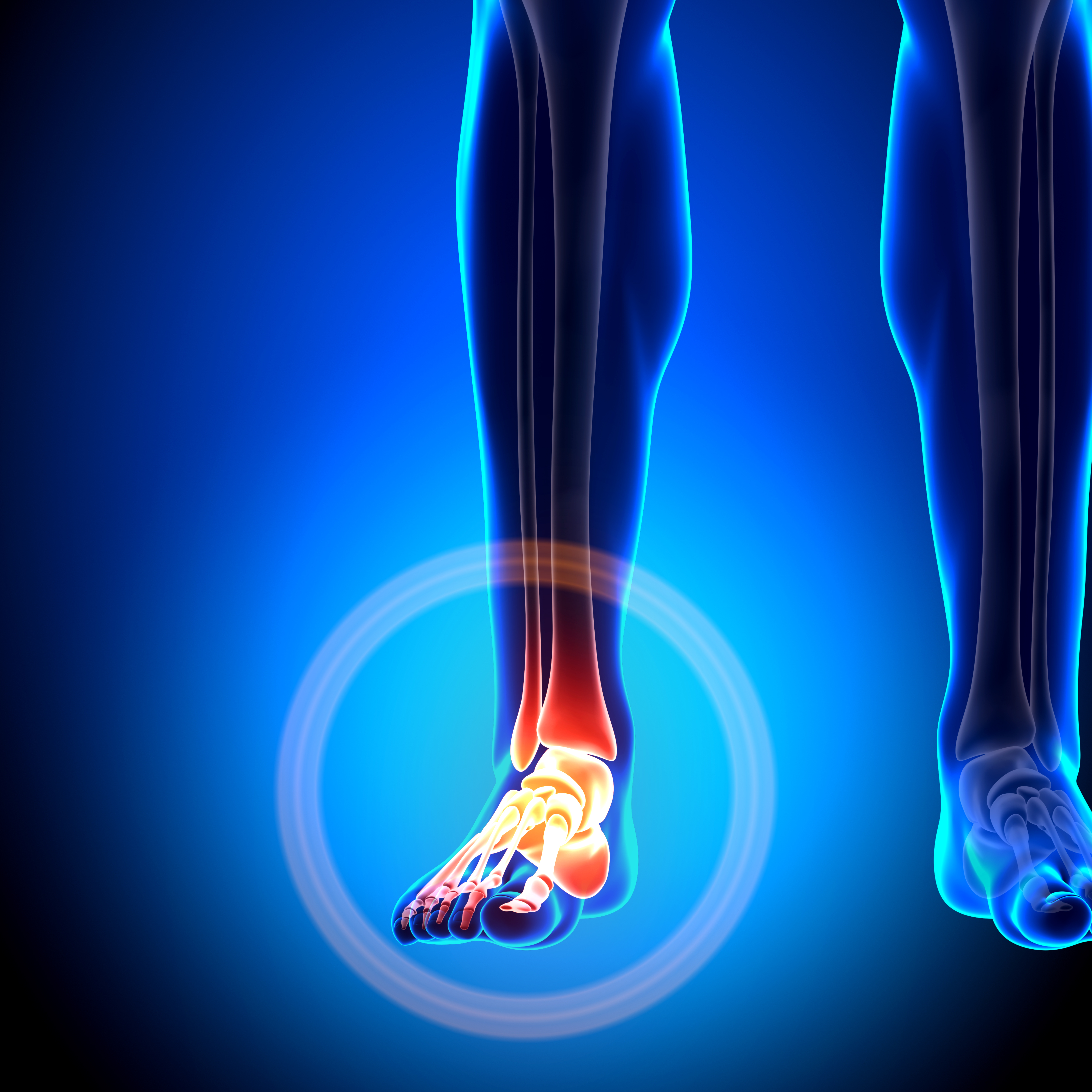 mls-laser-therapy-atlanta-american-foot-leg-specialists