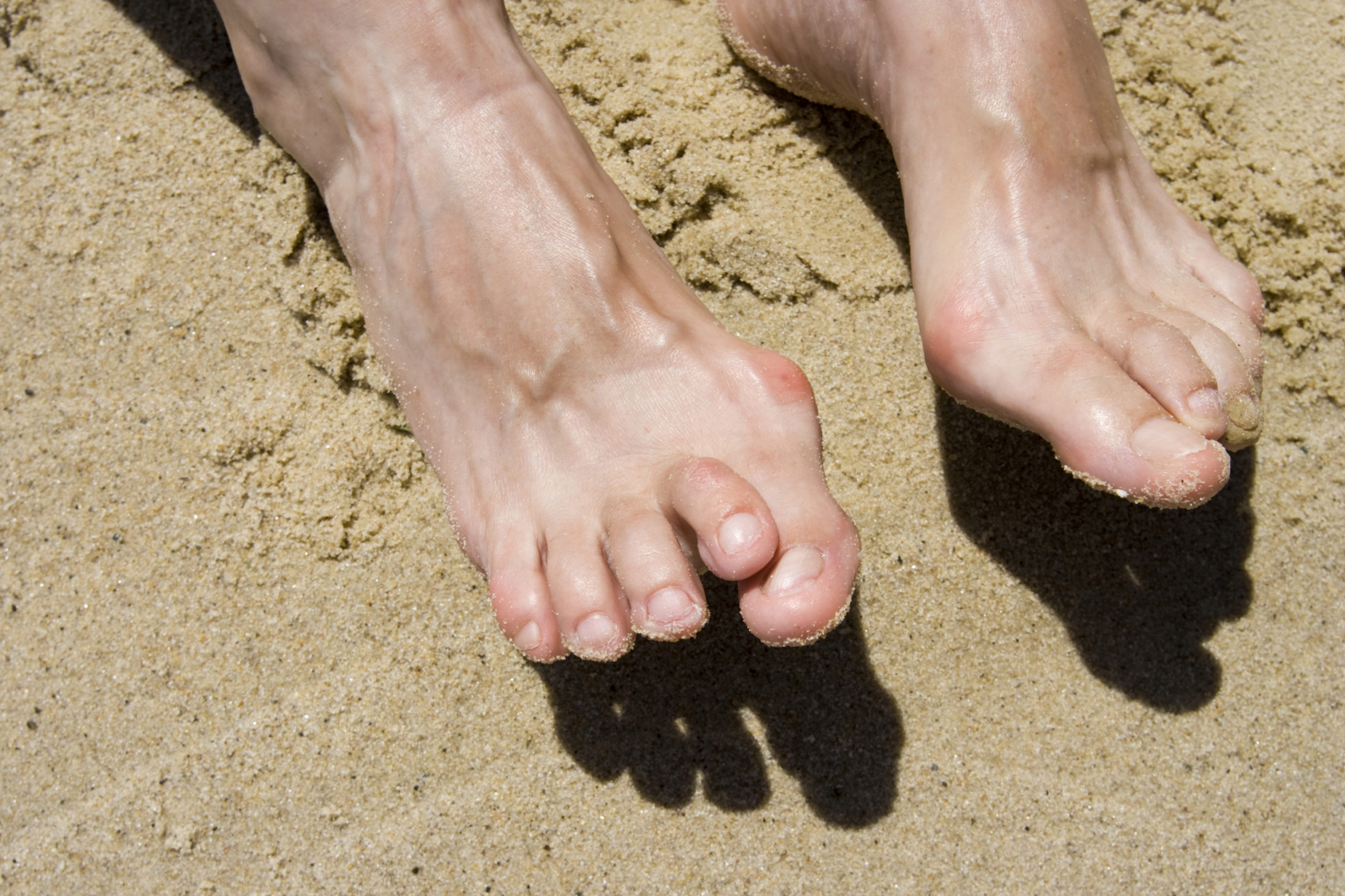 Toes between toes