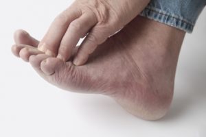 Diabetic Neuropathy