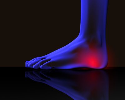 Five Heel Pain Causes | Atlanta Podiatry | American Foot & Leg Specialists