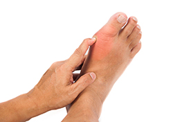 Read more about the article Severe Foot Pain: Gouty Arthritis
