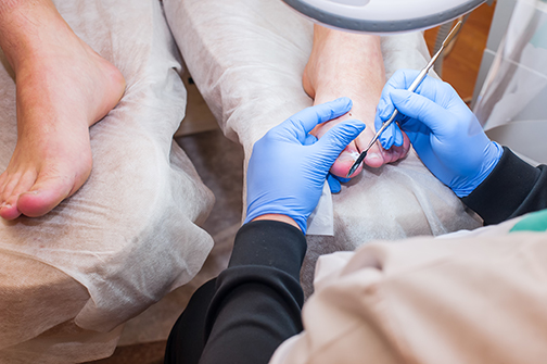 Read more about the article How To Fix Ingrown Toenails