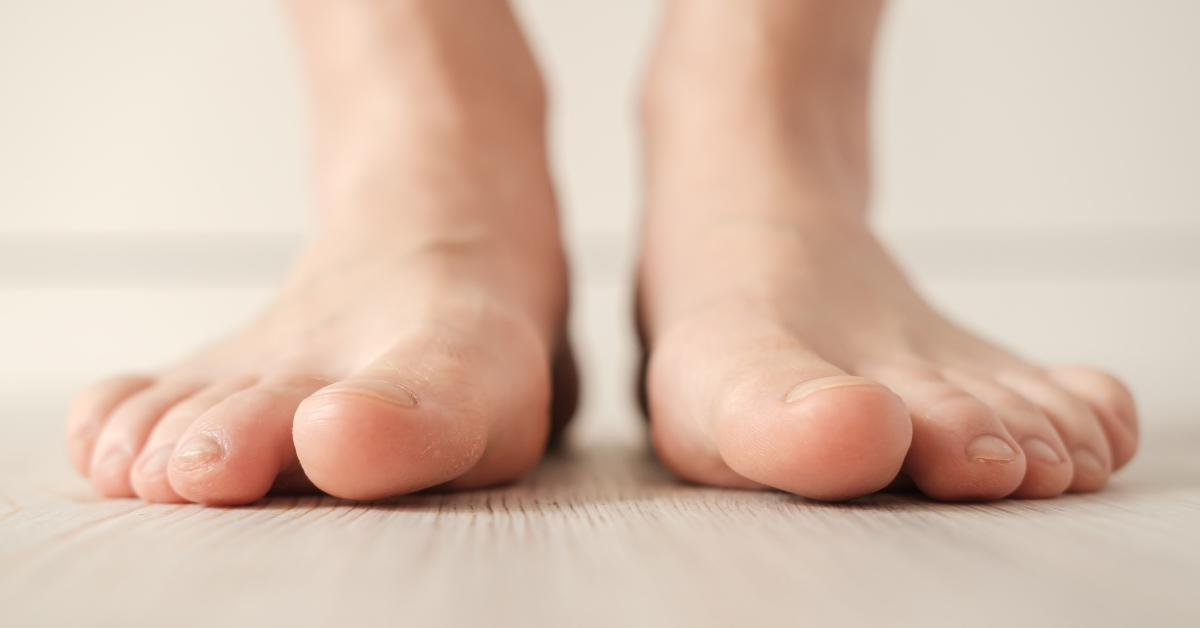 Read more about the article Common Causes of Foot Pain