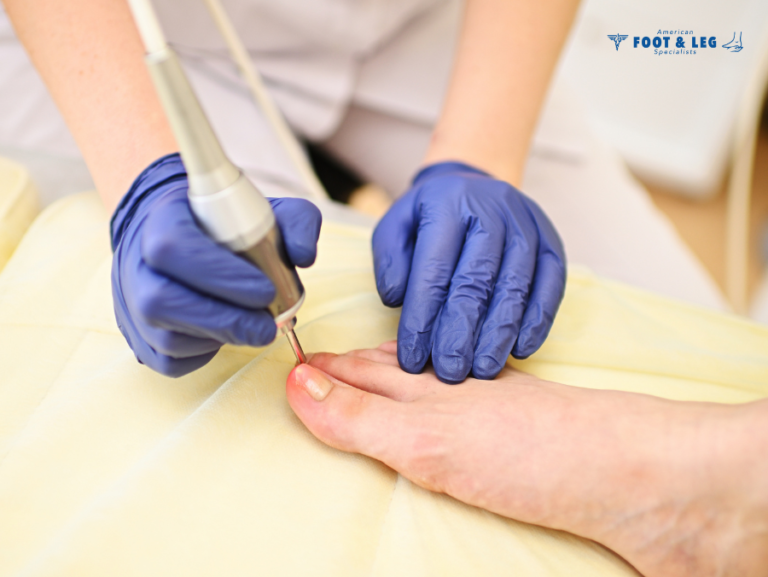 Read more about the article Laser Nail Treatment: A Modern Solution for Healthier Nails